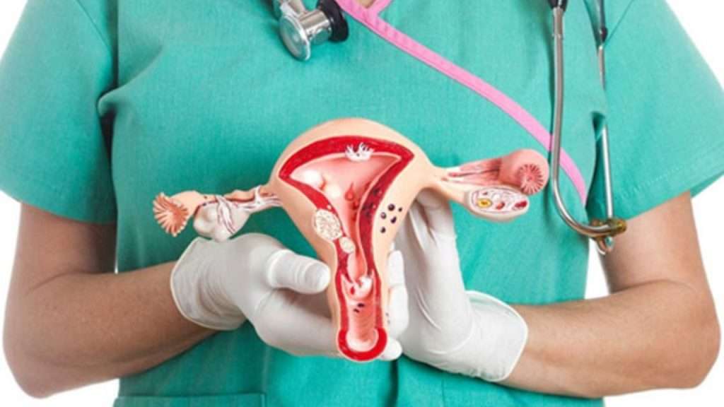 Hysterectomy - Period Problems